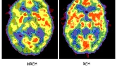 REM sleep and brain activity